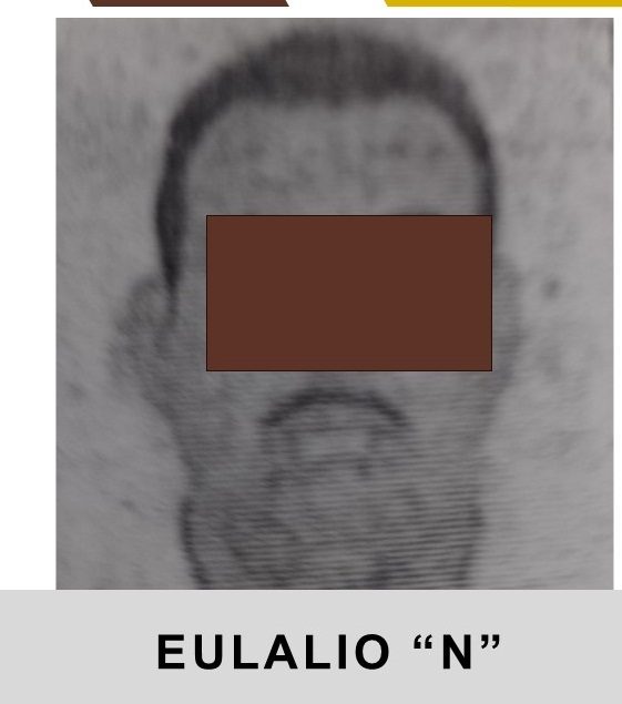 5 eulalio